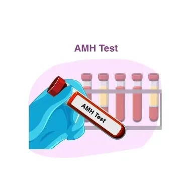 AMH Test