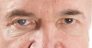 Diabetic Retinopathy ICD-10 Codes: Classification and Use in Gachibowli, Hyderabad