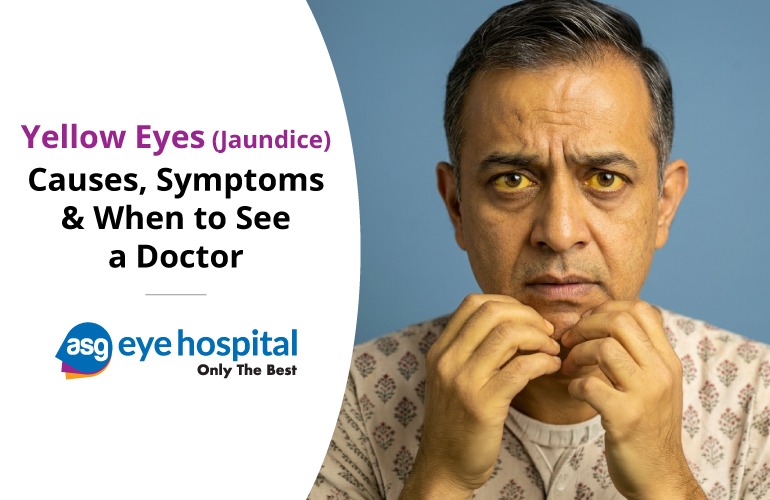 Yellow Eyes (Jaundice) Treatment in Vaishali Nagar, bilaspur: Causes, Symptoms & When to See a Doctor